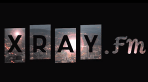xray-fm-1000px-screengrab*304